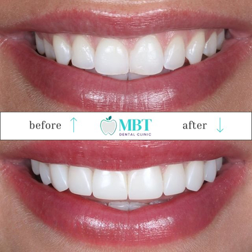 Slider image (8) MBT Dental Pro